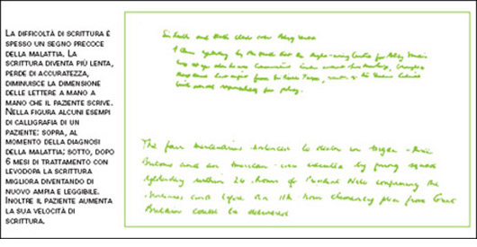 Grafia del Parkinsoniano