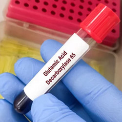 decarbossilasi decarbossilasi